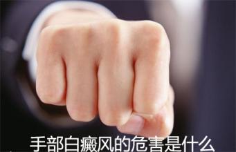 胳膊白癜风有什么影响