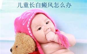 武汉婴儿白癜风怎样治疗 武汉宝宝白癜风能治好吗