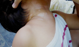 武汉患上白癜风能治疗吗 武汉白癜风怎么治疗好得快